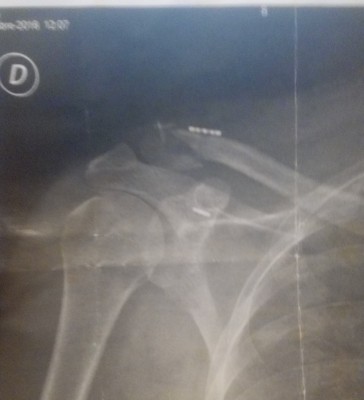 clavicule.jpg (1.87 Mio) Vu 16742 fois clavicule.jpg
